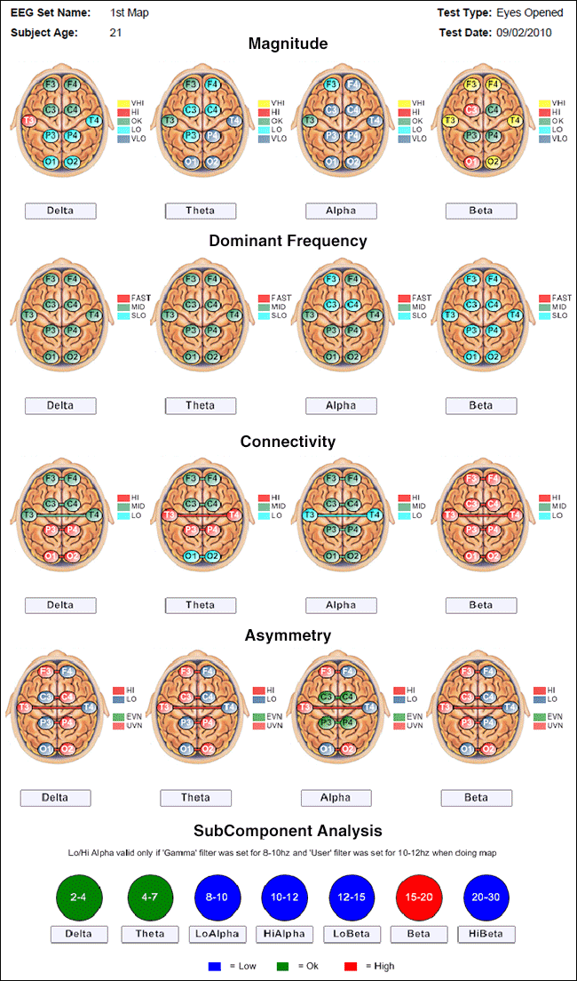 brain-map